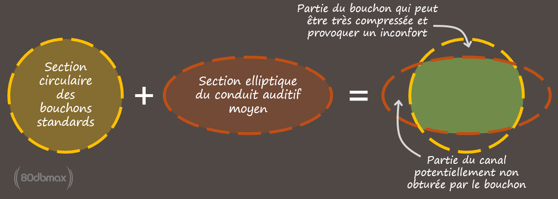 Des bouchons auditifs de forme elliptique