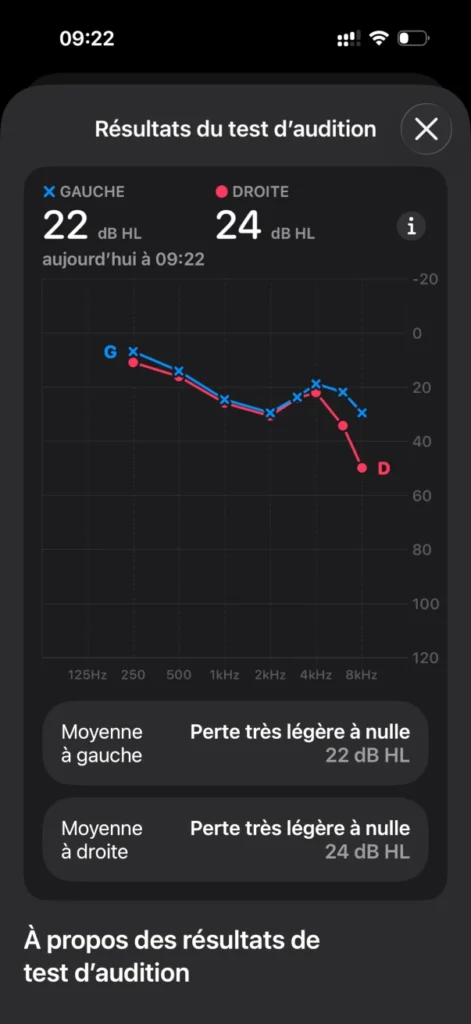 AirPods Pro 3 - audiométrie